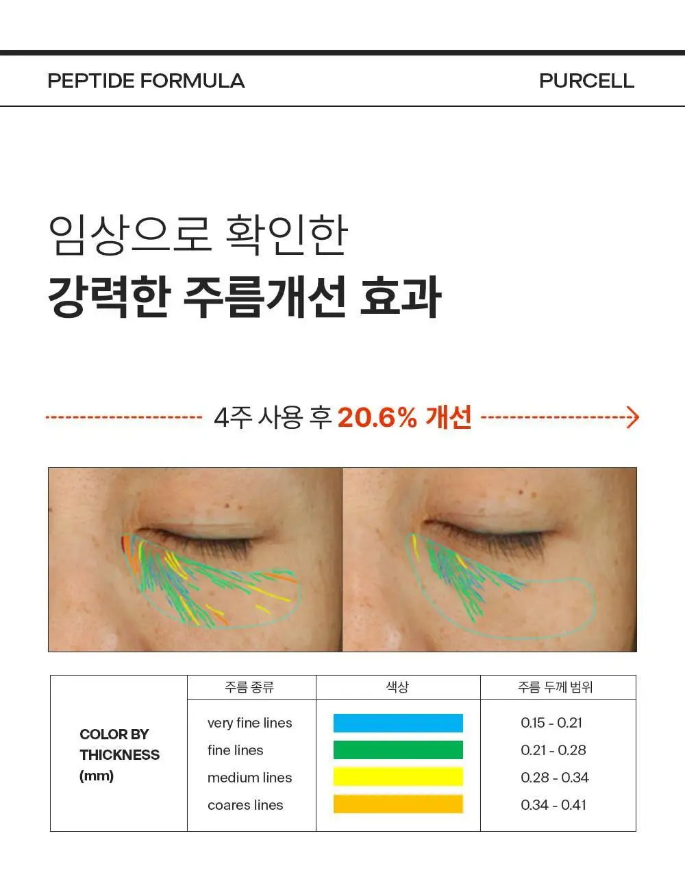 [주름리프팅] 퍼셀 82% 하이-도즈 펩타이드 콜라겐 앰플 20ml 상세페이지 13